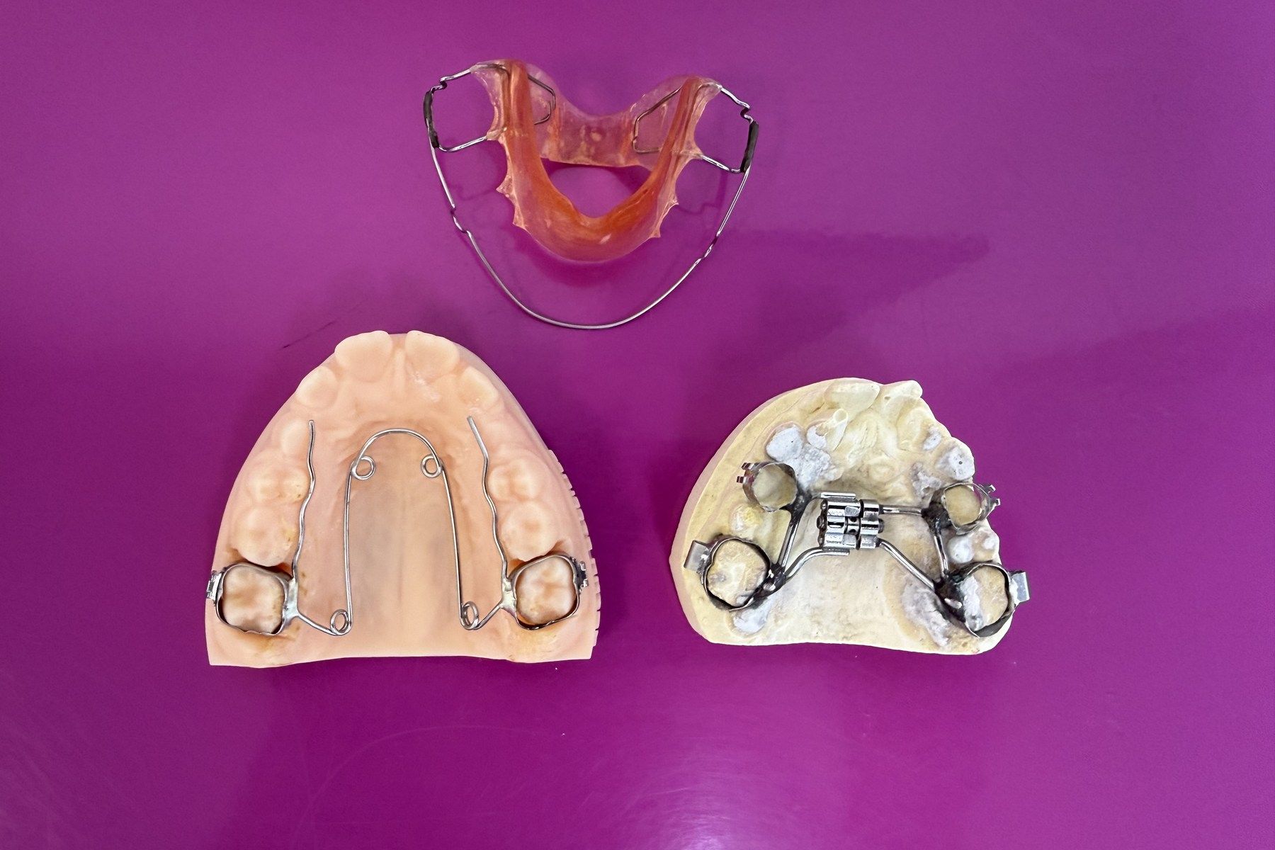 Appareils d'interception en denture mixte