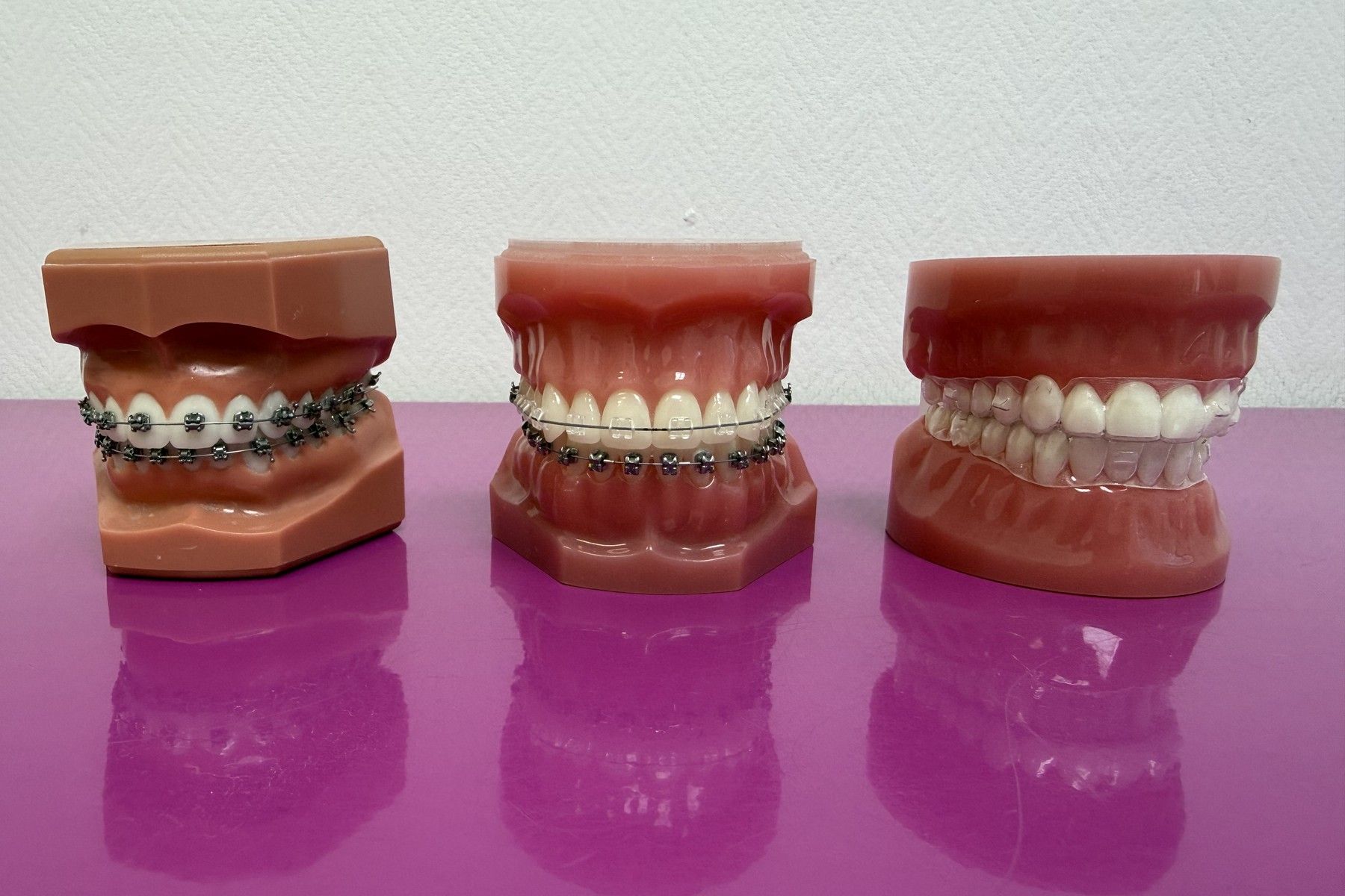 Bagues métalliques, bagues céramiques et gouttière transparente