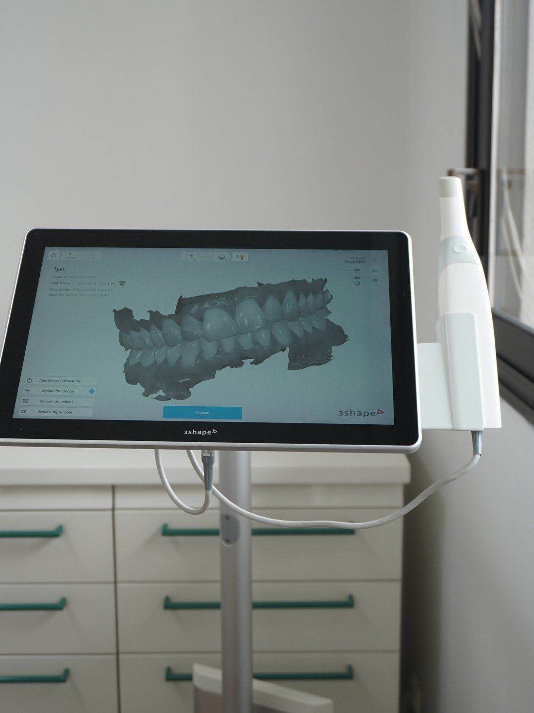 Modèle 3D des arcades dentaires à l'écran du scanner optique