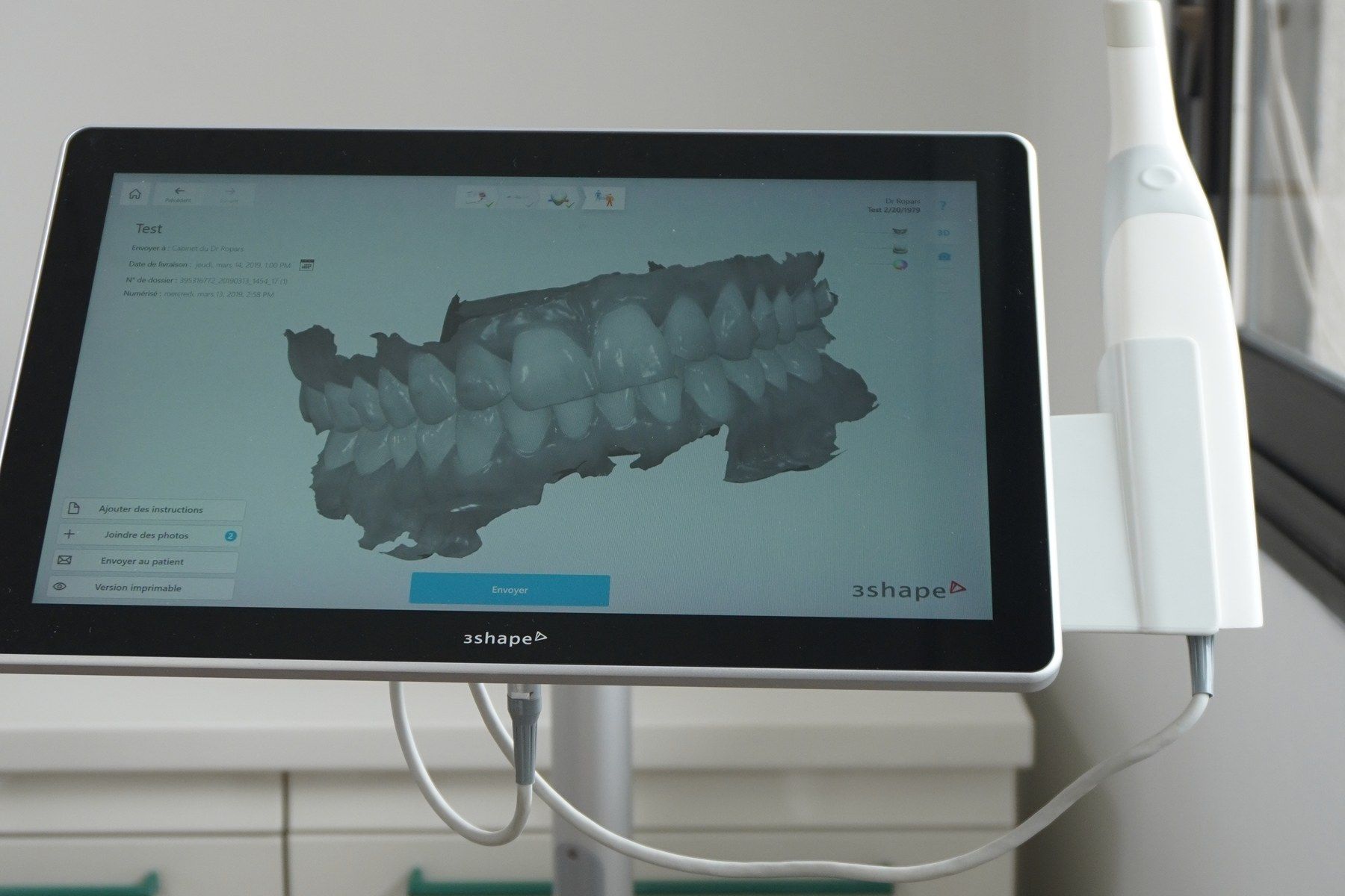 Modèle 3D des arcades à l'écran du scanner optique du cabinet